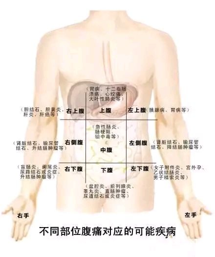 此图为腹部分区及不同区域对应的可能疾病