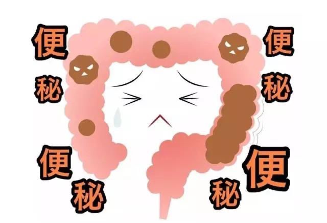 便秘小科普000000
