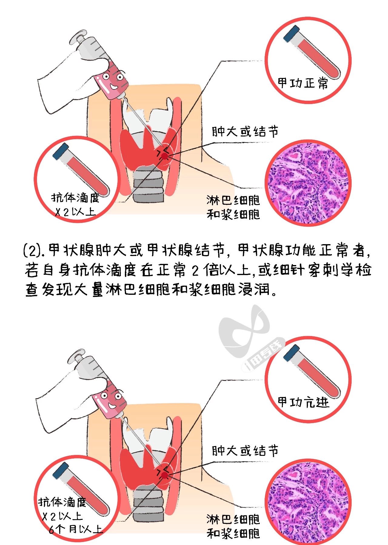 图片加载失败