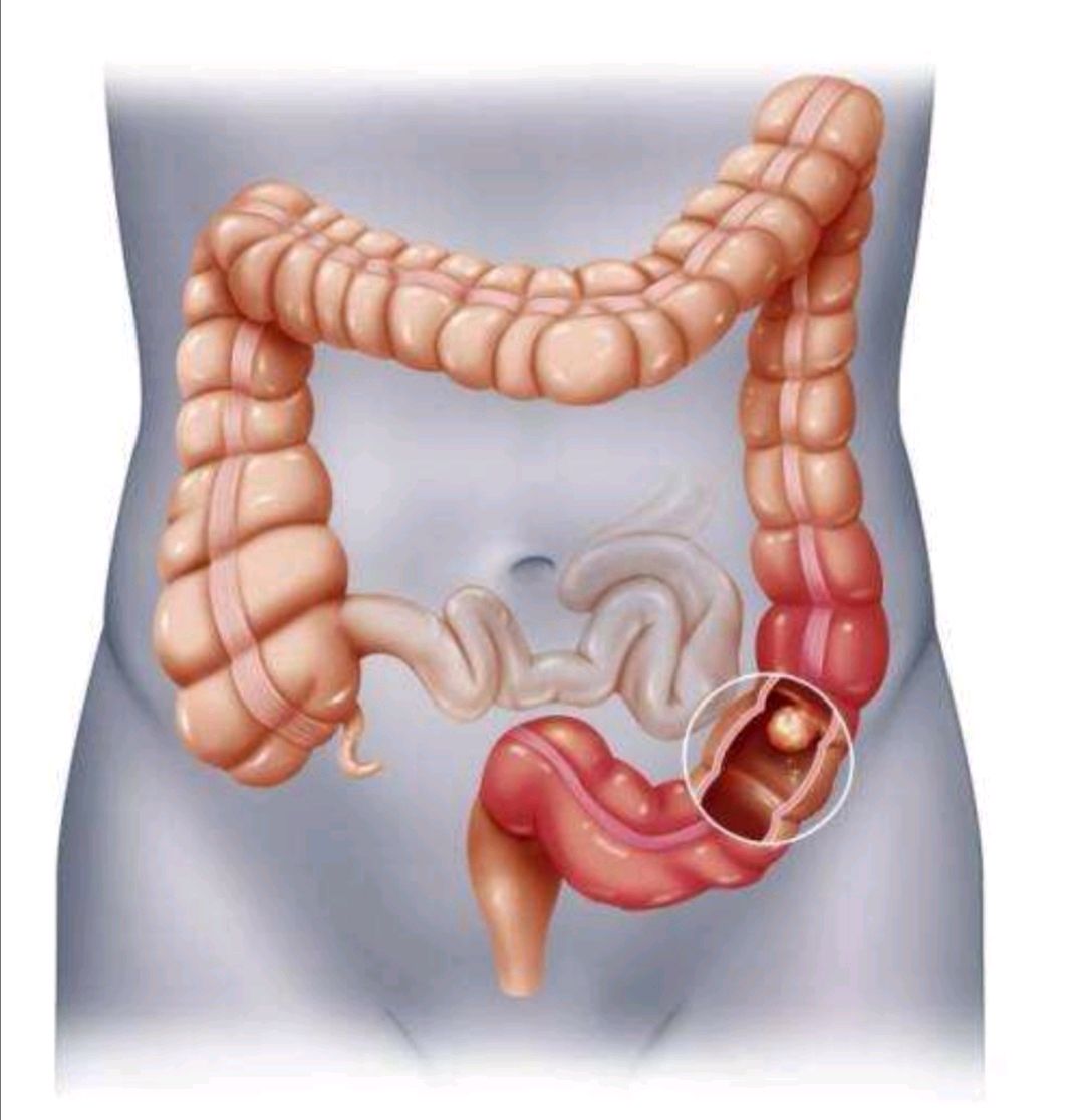 直肠的位置清晰图图片