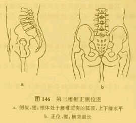 第三腰椎棘突位置图图片