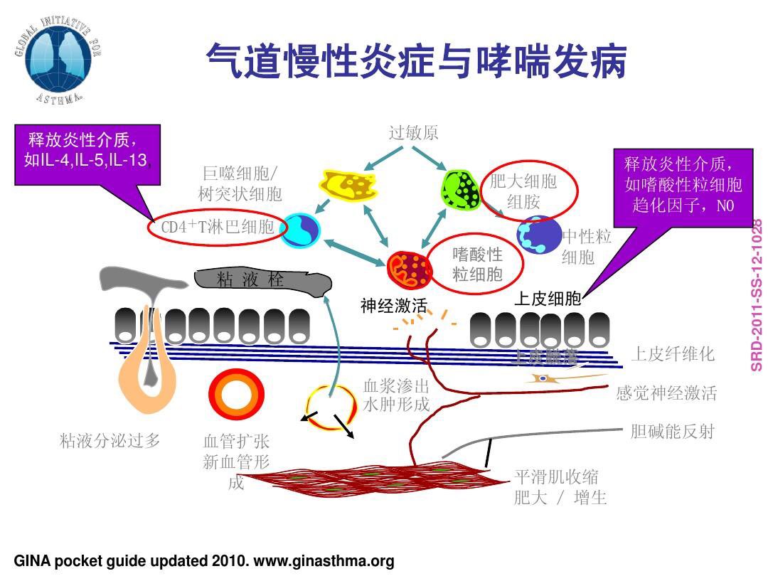 全面认识支气管哮喘病因诊断与治疗预防和生活注意事项