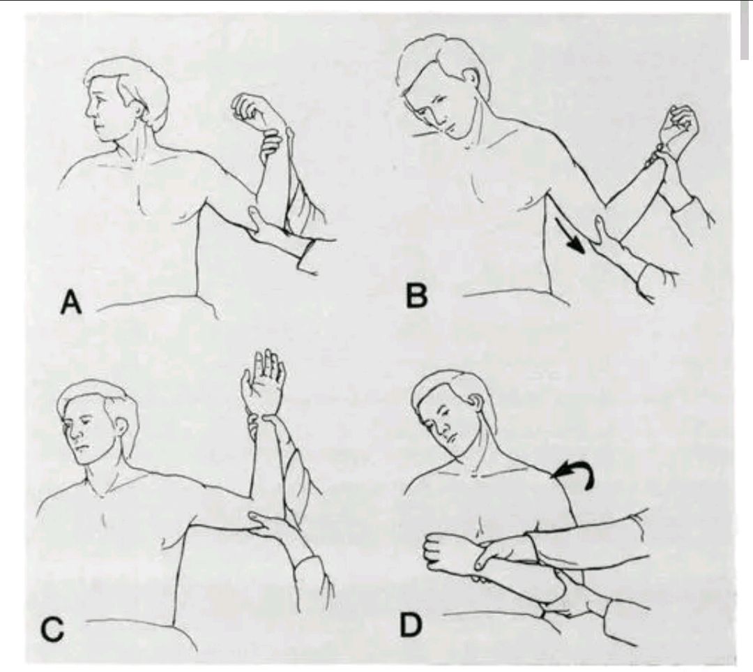 肩关节脱位脚蹬法图片