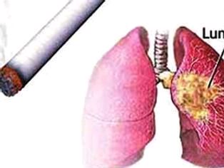 肺癌早期症状发现图片