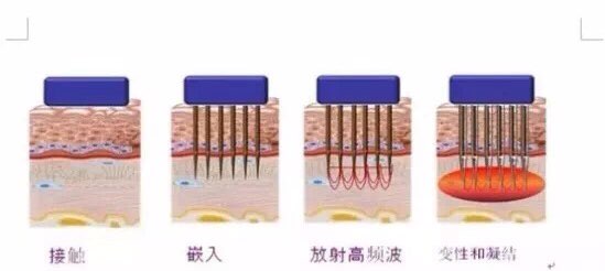 图片加载失败