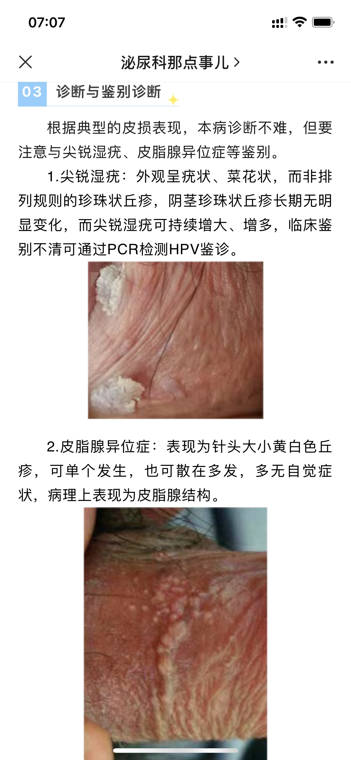 图片加载失败