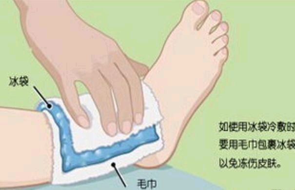 一,冰敷时间在急性受伤的24~72小时内冰敷,每隔2~3小时进行一次冰敷