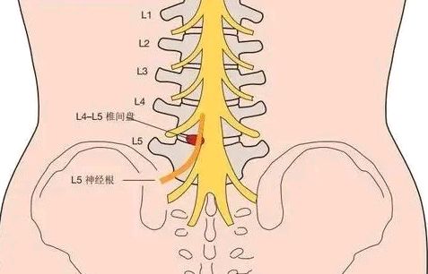 女性尾骶骨疼痛的原因图片