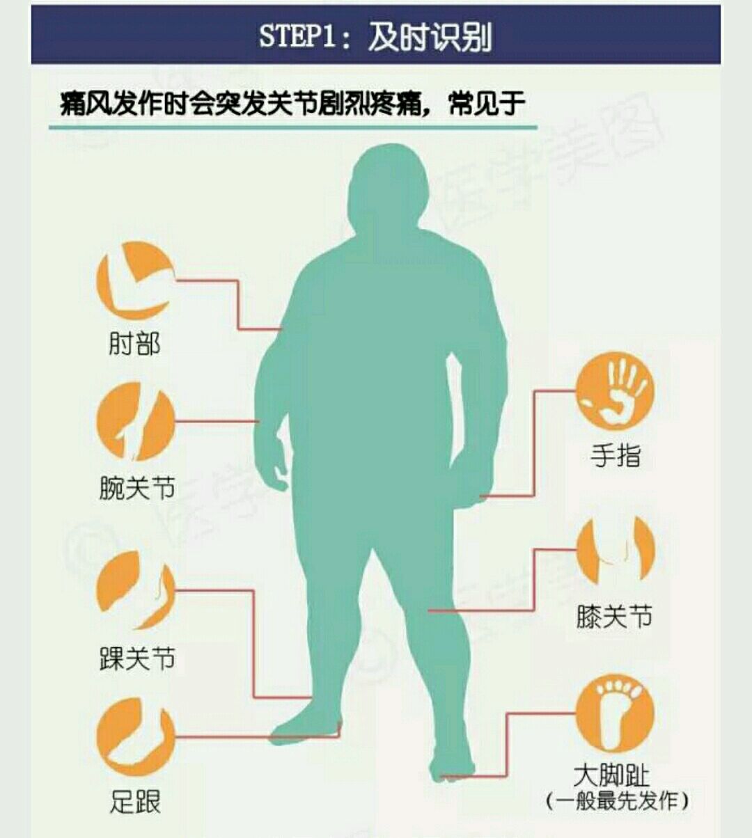 痛风的预防与治疗