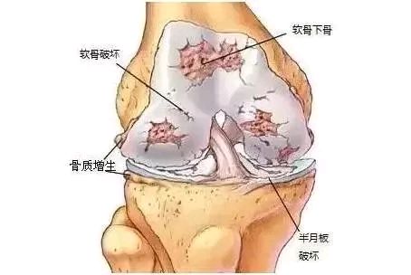 为什么会有单关节器械这份膝关节使用说明书，每个人都该看看！_https://www.jmylbn.com_新闻资讯_第4张