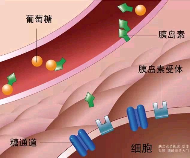 注射胰島素不僅可以很好地控制血糖,延緩糖尿病併發症的發生發展,能