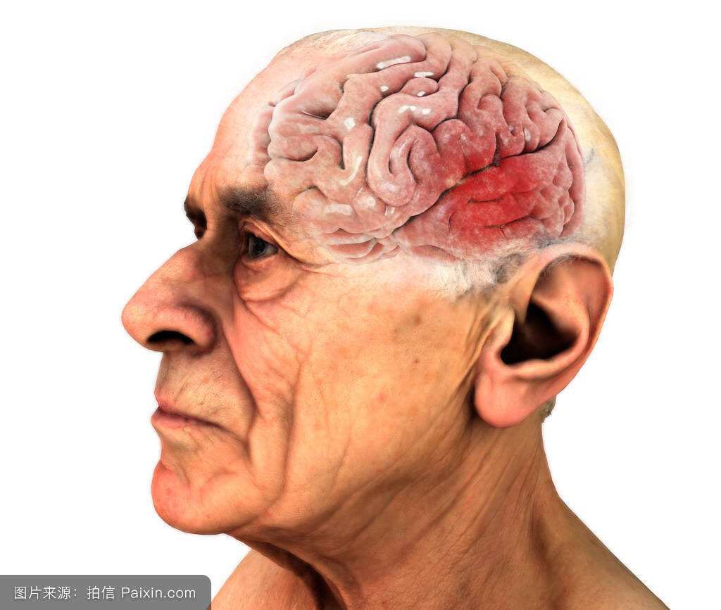 Can Head Trauma Cause Brain Tumor