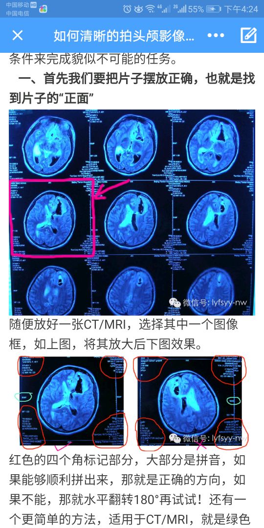 如何给医生看清楚你的片子