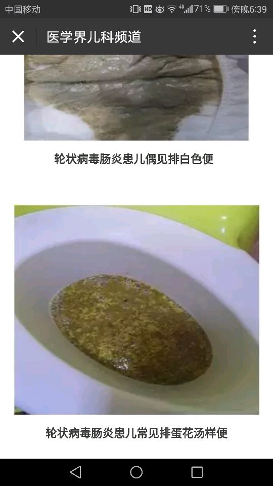 轮状病毒引起惊厥