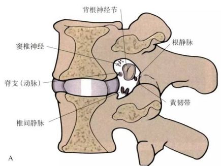 骨科醫生闢謠:腰突不是骨頭錯位,不能亂按! - 春雨醫生