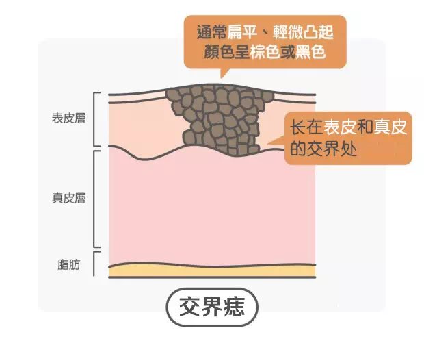 阴囊交界痣图片