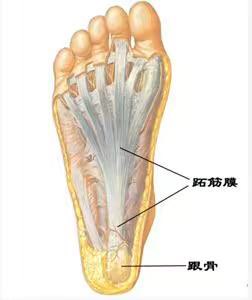 跖筋膜炎