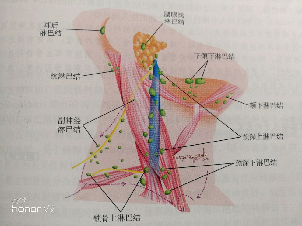 颈动脉鞘淋巴结图片