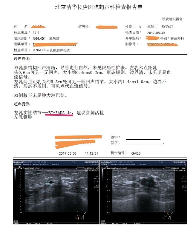 一文教你读懂乳腺结节超声报告及常见误区